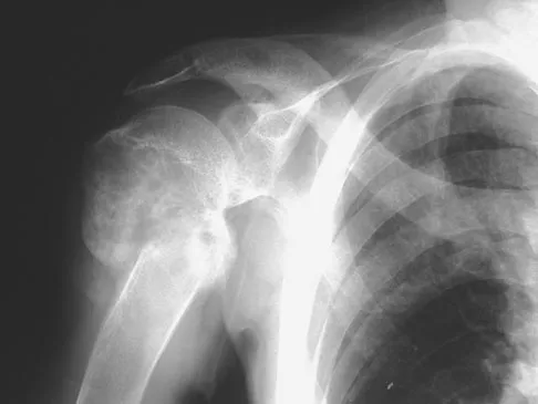 Basic Science 2008 Practice Questions: Set 3 (Solved) - Figure 44