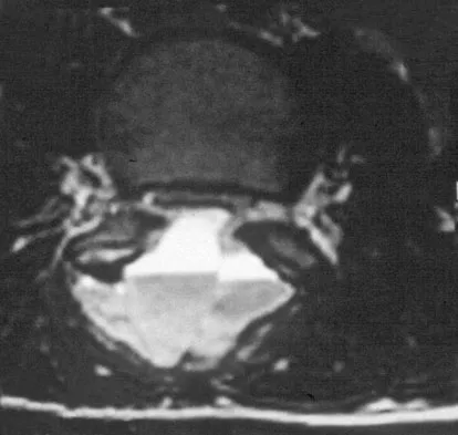 Basic Science 2008 Practice Questions: Set 3 (Solved) - Figure 55