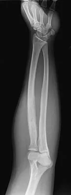 Basic Science 2008 Practice Questions: Set 3 (Solved) - Figure 57