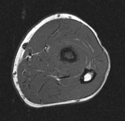 Basic Science 2008 Practice Questions: Set 3 (Solved) - Figure 60
