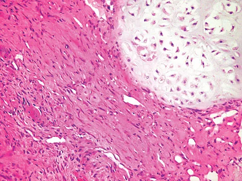 Basic Science 2008 Practice Questions: Set 3 (Solved) - Figure 75