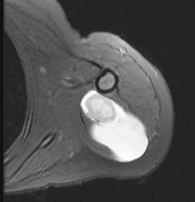 Basic Science 2008 Practice Questions: Set 3 (Solved) - Figure 9