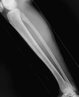Basic Science Board Review 2008: High-Yield MCQs (Set 4) - Figure 1