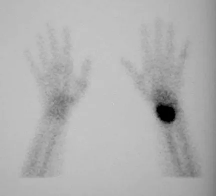 Basic Science Board Review 2008: High-Yield MCQs (Set 4) - Figure 17