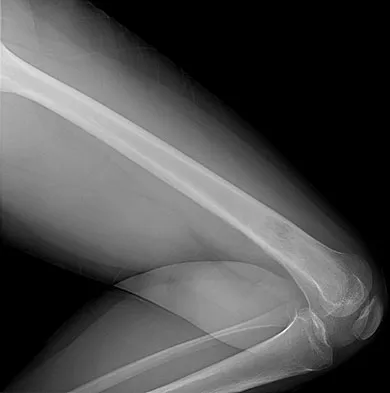 Basic Science Board Review 2008: High-Yield MCQs (Set 4) - Figure 21