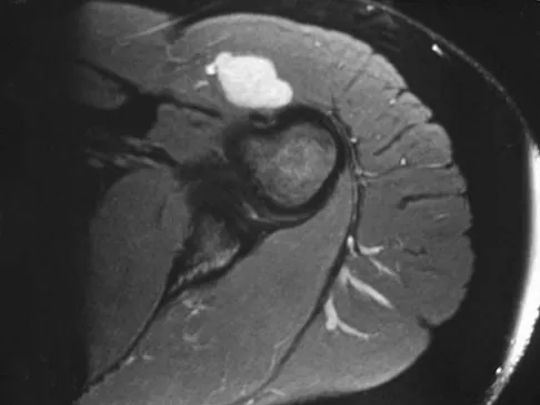 Basic Science Board Review 2008: High-Yield MCQs (Set 4) - Figure 38