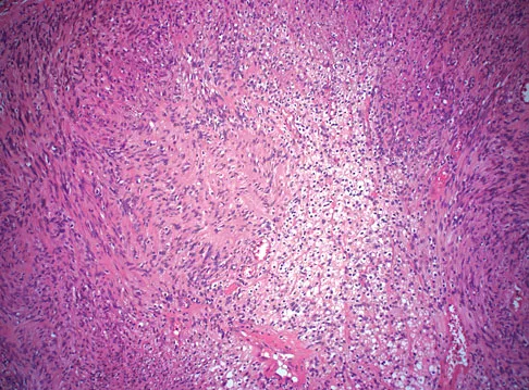 Basic Science Board Review 2008: High-Yield MCQs (Set 4) - Figure 39