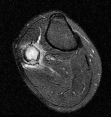 Basic Science Board Review 2008: High-Yield MCQs (Set 4) - Figure 4