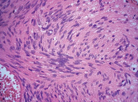 Basic Science Board Review 2008: High-Yield MCQs (Set 4) - Figure 40