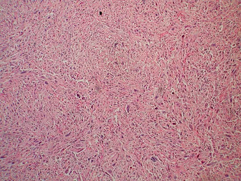 Basic Science Board Review 2008: High-Yield MCQs (Set 4) - Figure 42