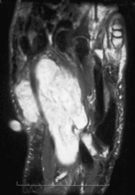 Basic Science Board Review 2008: High-Yield MCQs (Set 4) - Figure 51
