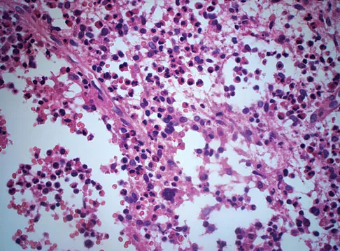 Basic Science Board Review 2008: High-Yield MCQs (Set 4) - Figure 54