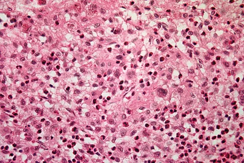 Basic Science Board Review 2008: High-Yield MCQs (Set 4) - Figure 55