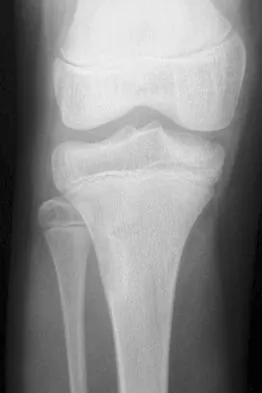 Basic Science Board Review 2008: High-Yield MCQs (Set 4) - Figure 6