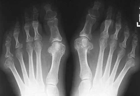 Foot & Ankle 2000 Practice Questions: Set 1 (Solved) - Figure 11