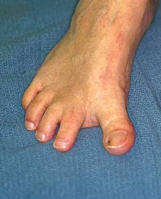 Foot & Ankle 2000 Practice Questions: Set 1 (Solved) - Figure 13