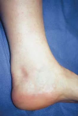 Foot & Ankle 2000 Practice Questions: Set 1 (Solved) - Figure 23