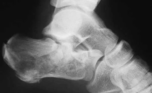 Foot & Ankle 2000 Practice Questions: Set 1 (Solved) - Figure 8