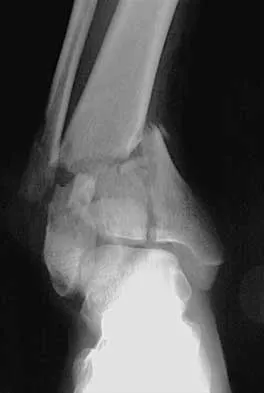 Foot & Ankle Board Review 2000: High-Yield MCQs (Set 2) - Figure 1