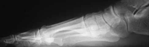 Foot & Ankle Board Review 2000: High-Yield MCQs (Set 2) - Figure 10