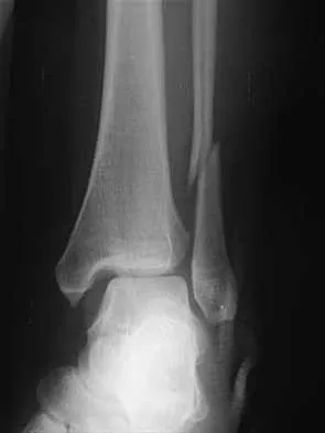 Foot & Ankle Board Review 2000: High-Yield MCQs (Set 2) - Figure 11