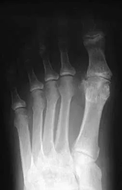 Foot & Ankle Board Review 2000: High-Yield MCQs (Set 2) - Figure 13