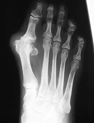 Foot & Ankle Board Review 2000: High-Yield MCQs (Set 2) - Figure 14