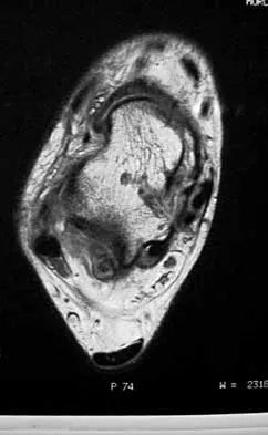 Foot & Ankle Board Review 2000: High-Yield MCQs (Set 2) - Figure 26