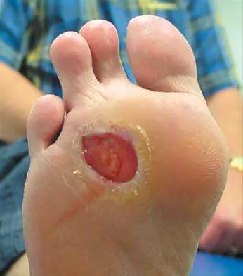 Foot & Ankle Board Review 2000: High-Yield MCQs (Set 2) - Figure 27