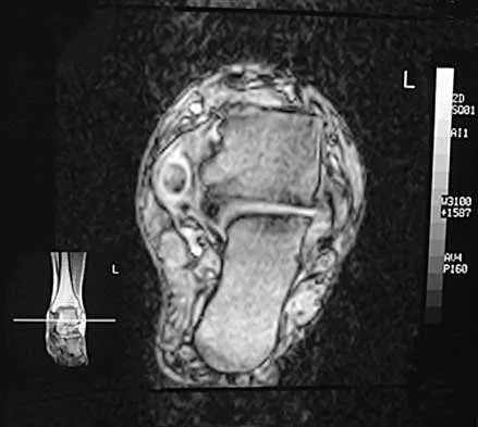 Foot & Ankle Board Review 2000: High-Yield MCQs (Set 2) - Figure 3