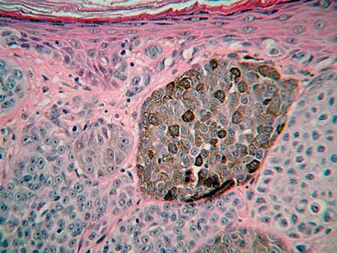 Foot & Ankle Board Review 2000: High-Yield MCQs (Set 2) - Figure 5