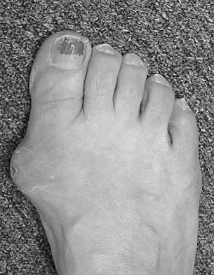 Foot & Ankle Board Review 2000: High-Yield MCQs (Set 2) - Figure 7