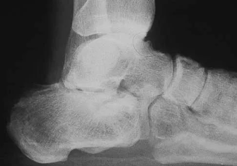 Foot & Ankle Board Review 2000: High-Yield MCQs (Set 2) - Figure 8