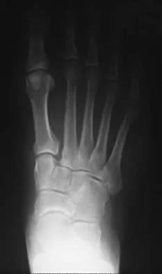 Foot & Ankle Board Review 2000: High-Yield MCQs (Set 2) - Figure 9