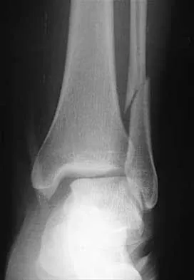 Foot & Ankle 2000 Practice Questions: Set 3 (Solved) - Figure 11