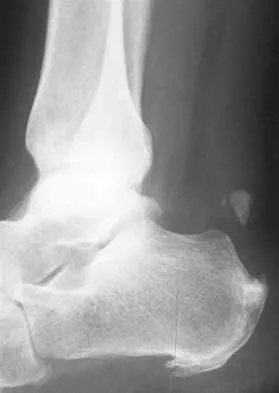 Foot & Ankle 2000 Practice Questions: Set 3 (Solved) - Figure 16