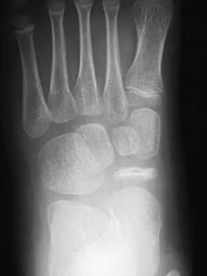 Foot & Ankle 2000 Practice Questions: Set 3 (Solved) - Figure 5