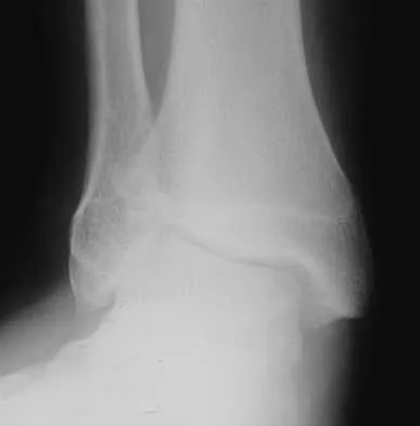 Foot & Ankle Board Review 2000: High-Yield MCQs (Set 4) - Figure 16