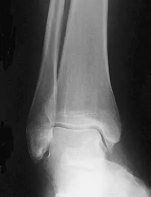 Foot & Ankle Board Review 2000: High-Yield MCQs (Set 4) - Figure 19