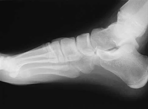 Foot & Ankle Board Review 2000: High-Yield MCQs (Set 4) - Figure 5