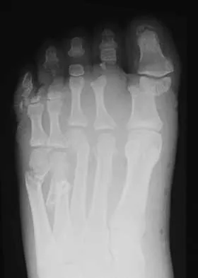 Foot & Ankle Board Review 2000: High-Yield MCQs (Set 4) - Figure 7