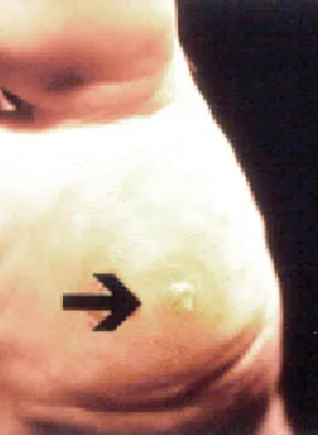 AAOS Foot & Ankle MCQs (Set 1): Trauma & Degenerative Disorders | ABOS Review