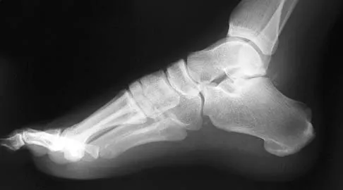 Foot & Ankle 2006 Practice Questions: Set 1 (Solved) - Figure 13