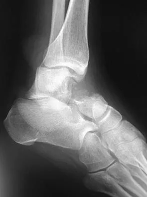 Foot & Ankle 2006 Practice Questions: Set 1 (Solved) - Figure 14