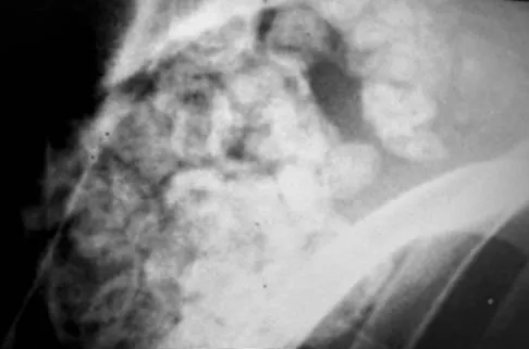 Foot & Ankle 2006 Practice Questions: Set 1 (Solved) - Figure 15