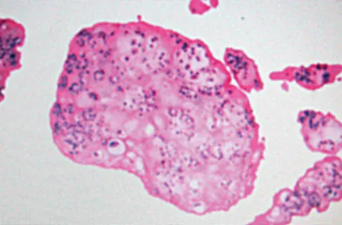 Foot & Ankle 2006 Practice Questions: Set 1 (Solved) - Figure 18