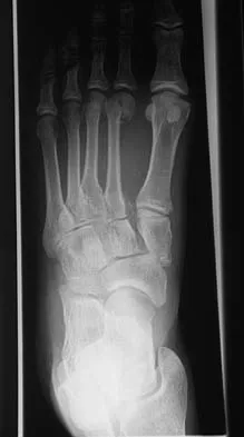 Foot & Ankle 2006 Practice Questions: Set 1 (Solved) - Figure 19