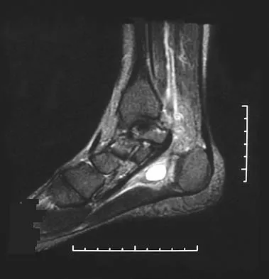 AAOS Orthopedic MCQs (Set 1): Spine Disorders, Sports Medicine & Arthroplasty | 2026 Board Review