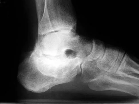 Foot & Ankle 2006 Practice Questions: Set 1 (Solved) - Figure 28