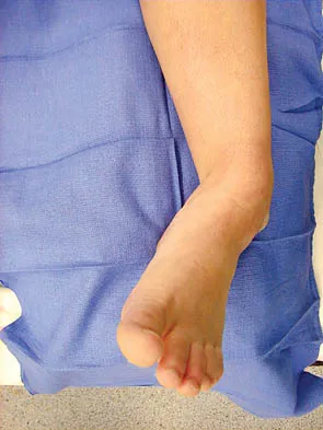 Foot & Ankle 2006 Practice Questions: Set 1 (Solved) - Figure 3